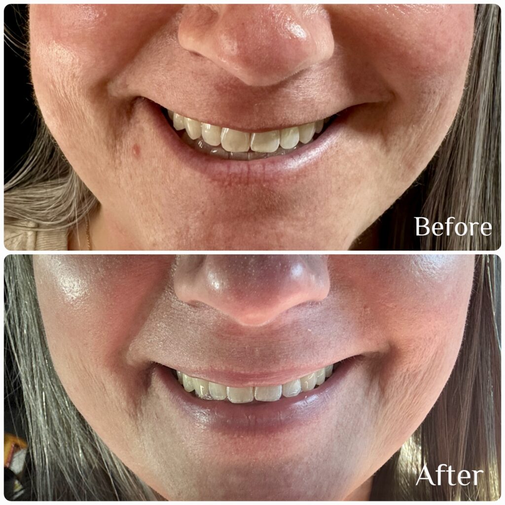 Why Medical-Grade Facials Outperform Spa Treatments