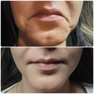 Before After Letybo DAO